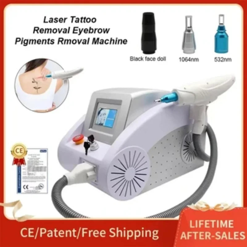 Láser Q-Switched ND Yag – Remoción de Tatuajes, Carbon Peel y Rejuvenecimiento Facial